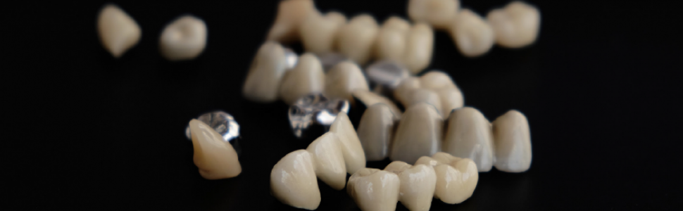 ARTYKUŁ PRZEGLĄDOWY. Elementy precyzyjne w leczeniu protetycznym. Przegląd piśmiennictwa