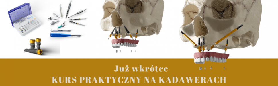 Sprawdź szczególy!