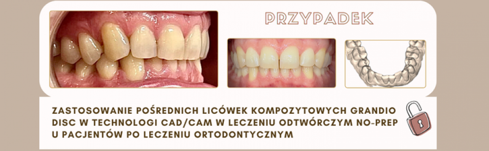 Czytaj artykuł w wolnym dostępnie