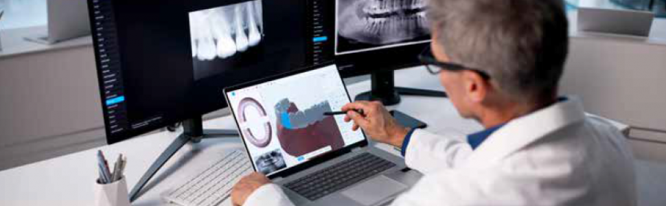OPIS PRZYPADKU. Czy istnieją granice implantacji natychmiastowej? Cyfrowo planowana i laserowo wspomagana implantacja natychmiastowa w okolicy zęba 16 z jednoczasowym zamkniętym podniesieniem dna zatoki szczękowej oraz augmentacją tkanek twardych i miękkich