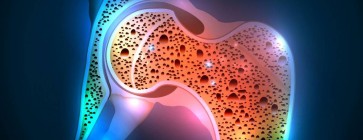 SPECJALISTA RADZI: Osteoporoza a choroby przyzębia