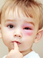 Lekarz wobec problemu dziecka maltretowanego – składanie zeznań