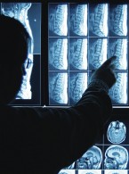  Pokonać raka – nadzieja w immunoterapii