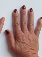 Pokonać Alzheimera: dźwięk i światło