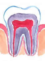 Ochrona żywej miazgi zębów oszlifowanych pod korony protetyczne
