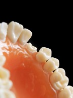 Częstość występowania i rodzaje urazów zębów stałych u pacjentów zgłaszających się do Katedry i Zakładu Stomatologii Wieku Rozwojowego Stomatologicznego Centrum Klinicznego Uniwersytetu  Medycznego w Lublinie w latach 2015‑2017