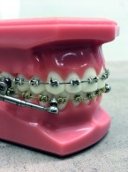 Zastosowanie aparatu PowerScope w leczeniu czynnościowym wad klasy II. Przegląd piśmiennictwa