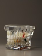 Zlokalizowane agresywne zapalenie przyzębia – opis przypadku