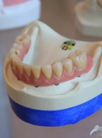 Czynniki wpływające na proces adaptacji do protez ruchomych