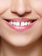 Zamknięcie diastemy z użyciem uniwersalnego kompozytu nanohybrydowego Harmonize™