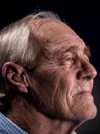 Choroba Alzheimera a kamień nazębny