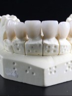 Jak uniknąć powikłań związanych z nieprawidłowościami podczas pobierania wycisków