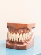 Naprawa pełnoceramicznej odbudowy zęba w odcinku przednim