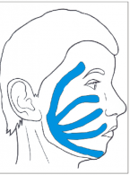 Ocena efektywności technik manualnych i plastrowania dynamicznego w redukcji powikłań pooperacyjnych po chirurgicznym leczeniu nowotworów w obrębie twarzowej części czaszki i szyi