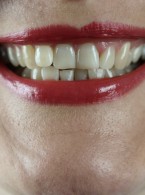 Zaburzenia okluzji i stawów skroniowo‑żuchwowych. Spojrzenie interdyscyplinarne dla lekarzy ogólnopraktykujących