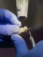 Atrycja – aktualny problem kliniczny na podstawie piśmiennictwa 