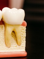 Profesjonalna profilaktyka stomatologiczna u pacjentów dorosłych