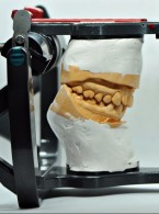 Nadwrażliwość, ból zęba – przyczyny i rozpoznanie