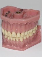 Błędy popełniane podczas zabiegów klinicznych i procedur laboratoryjnych w wykonawstwie protez płytowych