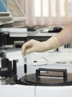 Przedoperacyjna diagnostyka laboratoryjna w praktyce chirurga stomatologicznego