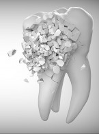 Metody diagnozowania pęknięć korzenia ze szczególnym uwzględnieniem metody wybarwiania wewnątrzkomorowego