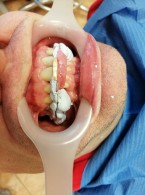 Szyna zwarciowa – metoda wykonania. Opis przypadku