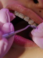 Inwazyjna resorpcja przyszyjkowa zęba siecznego przyśrodkowego w trakcie leczenia ortodontycznego