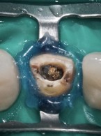 Część I. Rekonstrukcje tymczasowe