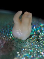 Fotodoncja – nowa dziedzina stomatologii 