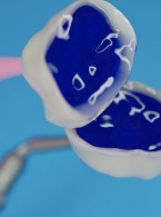 Powtórne leczenie endodontyczno-rekonstrukcyjne – możliwości i ograniczenia