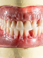 Obiektywy w fotografii stomatologicznej