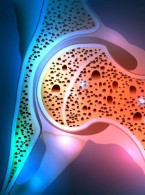 SPECJALISTA RADZI: Osteoporoza a choroby przyzębia