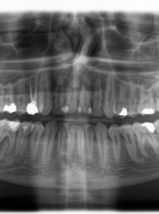 Codzienne przypadki krakowskiego endomaniaka (...)
