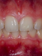 Część 5. Wpływ trójkąta ekspozycji na dokumentację fotograficzną 