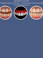 PRZECZYTAJ ARTYKUŁ W WOLNYM DOSTĘPIE