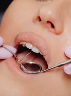 Skuteczność 8% argininy w leczeniu nadwrażliwości zębiny