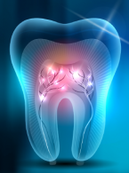 Systemy kanałów korzeniowych w kształcie litery C występujące obustronnie w pierwszych trzonowcach żuchwy: opis przypadku i przegląd piśmiennictwa
