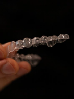 Estetyczne postępowanie w przypadku starcia zębów: aktualne koncepcje