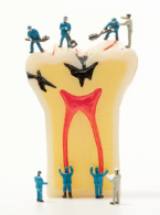 ARTYKUŁ ORYGINALNY. Trudności w diagnozowaniu pionowych złamań korzeni zębów leczonych endodontycznie 