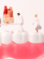 STRESZCZENIA. Przewlekła przetoka podbródkowa pochodzenia zębowego początkowo błędnie zdiagnozowana jako nieodzębowa zmiana patologiczna - opis przypadku