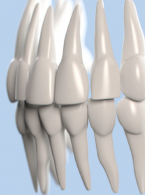 Ustalenie centralnego zwarcia z zastosowaniem Centric Tray w praktyce stomatologa