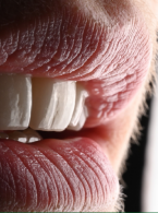 Digital analysis and treatment planning in practice – application of the digital patient avatar in the correction of gummy smile 