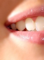 Okołowargowe zapalenie skóry spowodowane stosowaniem pasty do zębów z wysoką zawartością fluoru-opis przypadku i przegląd piśmiennictwa