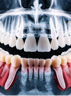 ARTYKUŁ PRZEGLĄDOWY. Jak rozpoznać prawidłowe struktury anatomiczne w stomatologicznych badaniach radiologicznych? Zdjęcia wewnątrzustne i pantomograficzne 