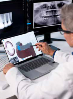 OPIS PRZYPADKU. Czy istnieją granice implantacji natychmiastowej? Cyfrowo planowana i laserowo wspomagana implantacja natychmiastowa w okolicy zęba 16 z jednoczasowym zamkniętym podniesieniem dna zatoki szczękowej oraz augmentacją tkanek twardych i miękkich