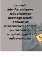 Przczytaj artykuł w wolnym dostępie!