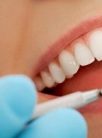 Złamania poziome korzeni w zębach bochnych - opisy przypadków