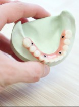 Rozwiązywanie problemów w trakcie i po leczeniu endodontycznym