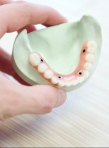 Rozwiązywanie problemów w trakcie i po leczeniu endodontycznym