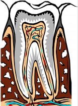 Odbudowa tkanek po leczeniu endodontycznym